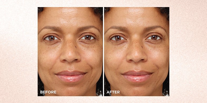 Before and after skincare routine focused on hydration and elasticity improvement products